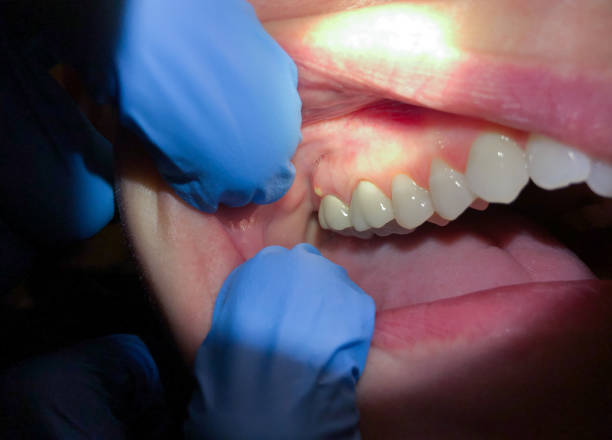 Best Emergency Broken Tooth Repair in Grenada, MS